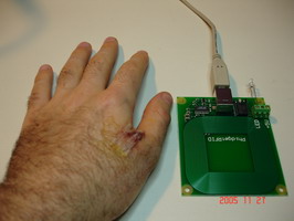 RFID implant